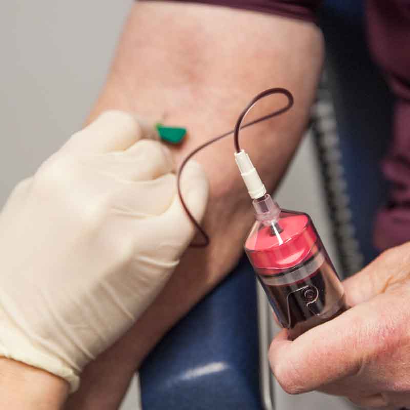 Blood being drawn into a 3C Patch Device